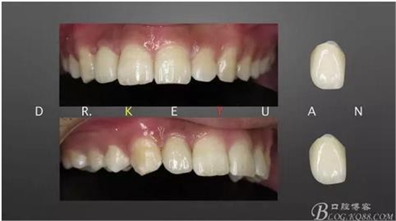 360截圖20170120135330957.jpg 360截圖20170120135330957.jpg