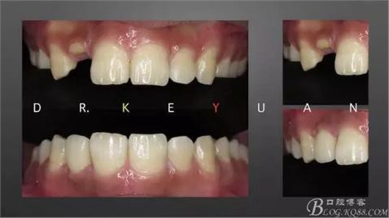 360截圖20170120135340446.jpg 360截圖20170120135340446.jpg