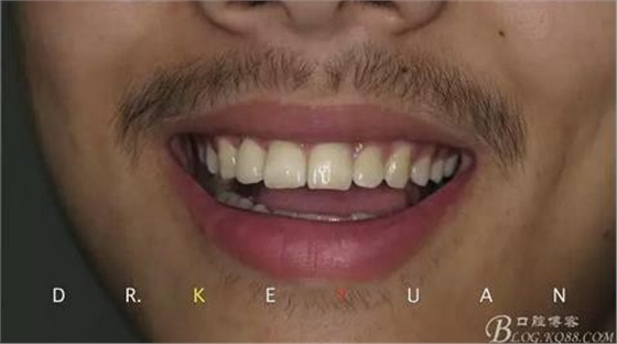 360截圖20170120135349374.jpg 360截圖20170120135349374.jpg