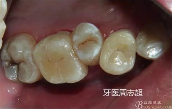 360截圖20170120150155336.jpg 360截圖20170120150155336.jpg