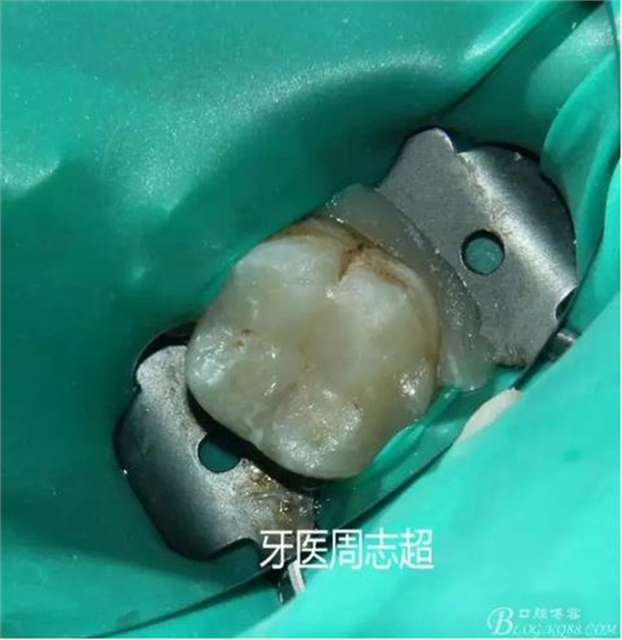 360截圖20170120150232116.jpg 360截圖20170120150232116.jpg