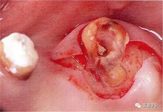 360截圖20170120171131583.jpg 360截圖20170120171131583.jpg