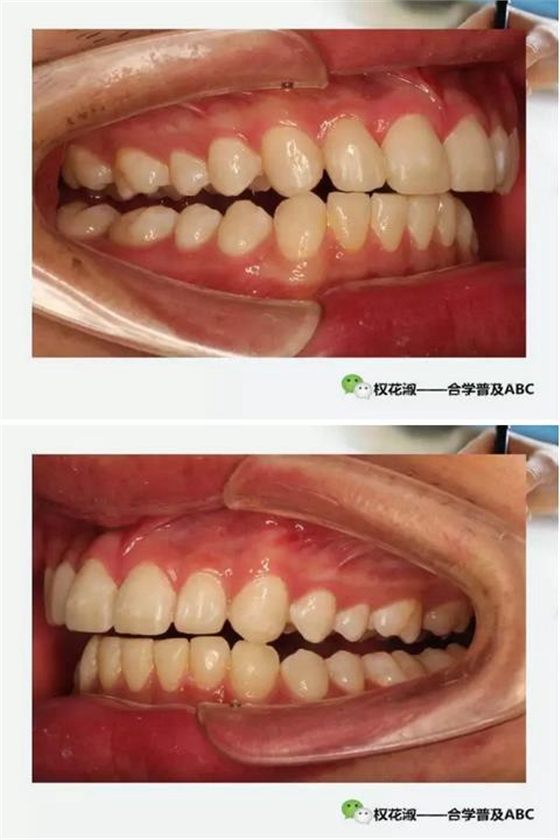 360截圖20170121130101615.jpg 360截圖20170121130101615.jpg