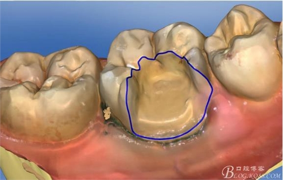 360截圖20170122165742377.jpg 360截圖20170122165742377.jpg