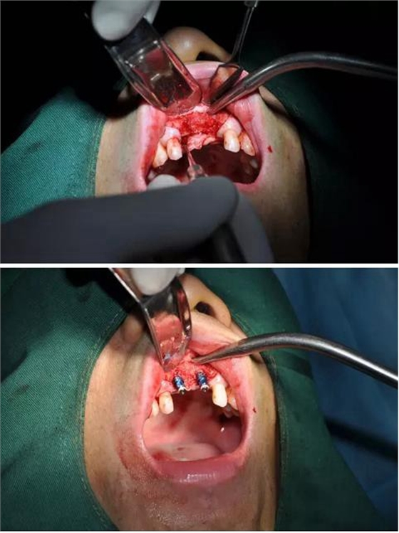 360截圖20170123085930476.jpg 360截圖20170123085930476.jpg