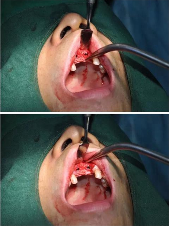 360截圖20170123085943081.jpg 360截圖20170123085943081.jpg