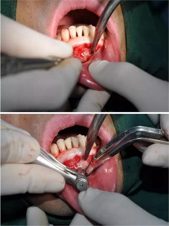 360截圖20170123090027788.jpg 360截圖20170123090027788.jpg