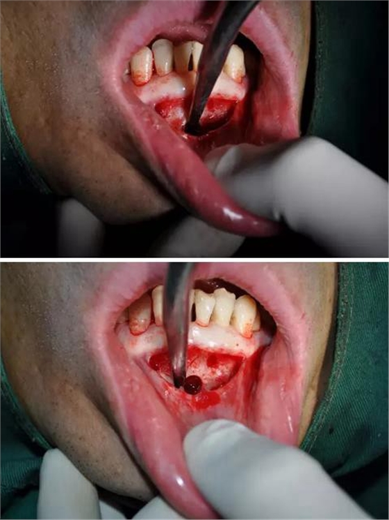 360截圖20170123090038500.jpg 360截圖20170123090038500.jpg