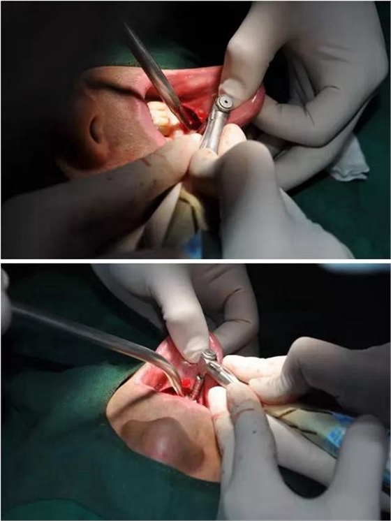 360截圖20170123090059044.jpg 360截圖20170123090059044.jpg