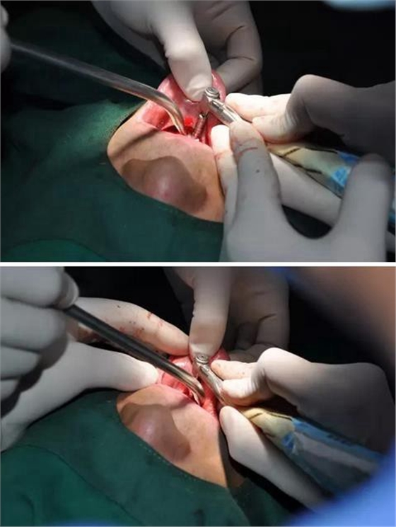 360截圖20170123090119305.jpg 360截圖20170123090119305.jpg