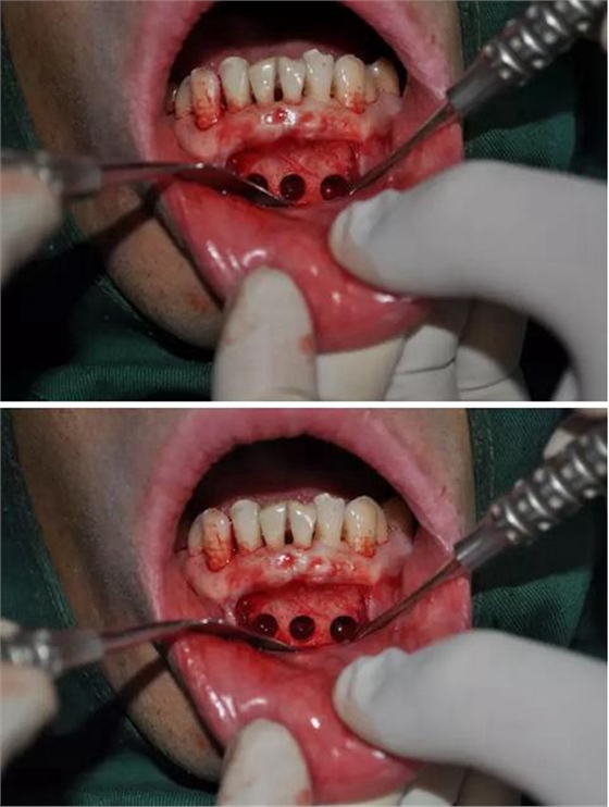 360截圖20170123090220141.jpg 360截圖20170123090220141.jpg