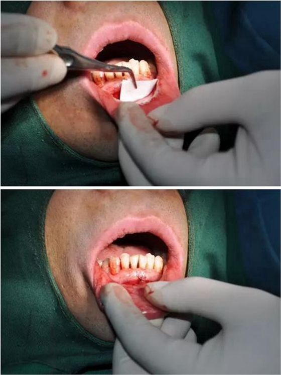 360截圖20170123090241761.jpg 360截圖20170123090241761.jpg