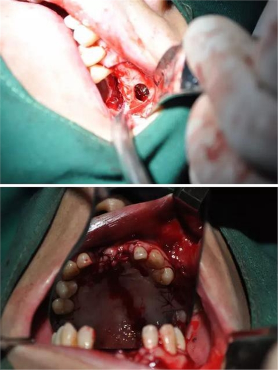 360截圖20170123090410684.jpg 360截圖20170123090410684.jpg