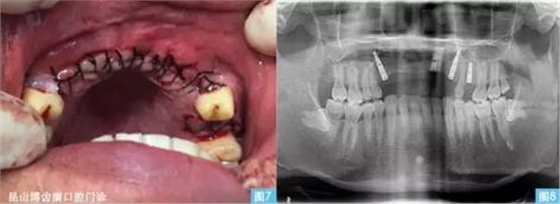 360截圖20170123095122654.jpg 360截圖20170123095122654.jpg