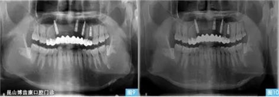 360截圖20170123095130742.jpg 360截圖20170123095130742.jpg