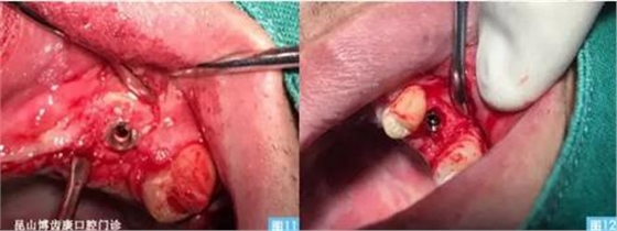 360截圖20170123095139093.jpg 360截圖20170123095139093.jpg