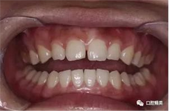 360截圖20170123100755823.jpg 360截圖20170123100755823.jpg