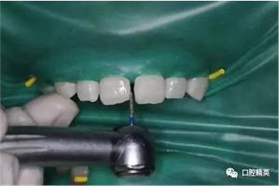 360截圖20170123100820295.jpg 360截圖20170123100820295.jpg