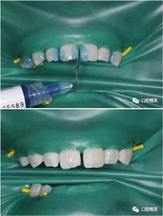 360截圖20170123100829983.jpg 360截圖20170123100829983.jpg