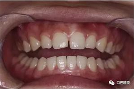 360截圖20170123100946271.jpg 360截圖20170123100946271.jpg