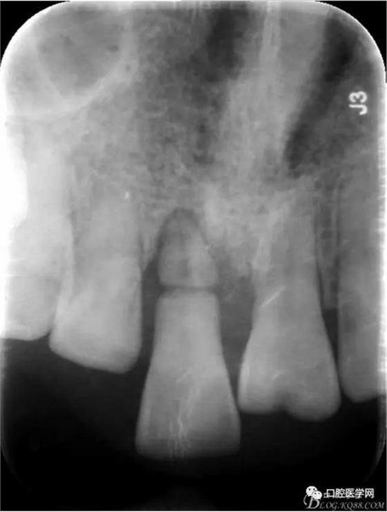 360截圖20170123112727300.jpg 360截圖20170123112727300.jpg