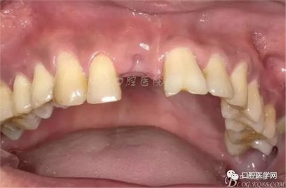 360截圖20170123112758991.jpg 360截圖20170123112758991.jpg