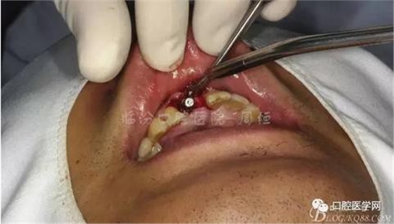 360截圖20170123112824195.jpg 360截圖20170123112824195.jpg