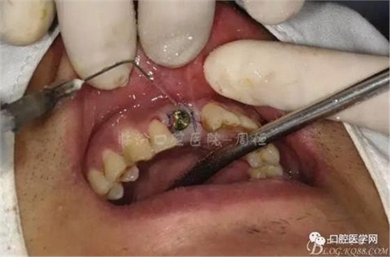 360截圖20170123113002364.jpg 360截圖20170123113002364.jpg