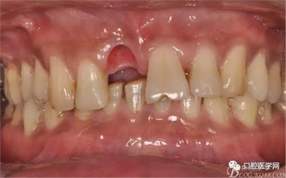 360截圖20170123113012408.jpg 360截圖20170123113012408.jpg