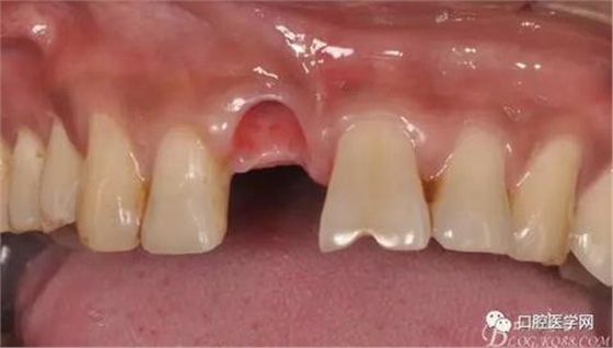 360截圖20170123113021820.jpg 360截圖20170123113021820.jpg