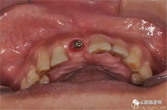 360截圖20170123113033366.jpg 360截圖20170123113033366.jpg