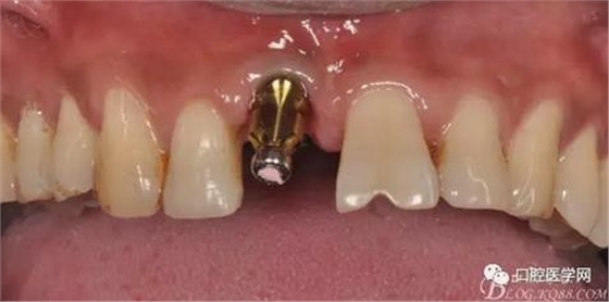 360截圖20170123113041354.jpg 360截圖20170123113041354.jpg