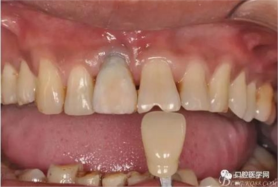 360截圖20170123113058326.jpg 360截圖20170123113058326.jpg