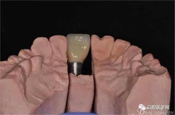 360截圖20170123113117307.jpg 360截圖20170123113117307.jpg