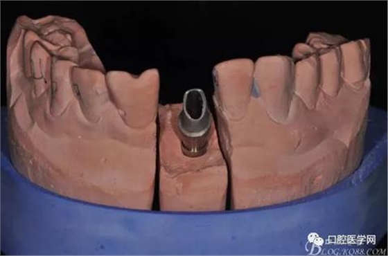 360截圖20170123113126926.jpg 360截圖20170123113126926.jpg