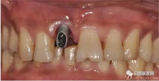 360截圖20170123113202356.jpg 360截圖20170123113202356.jpg