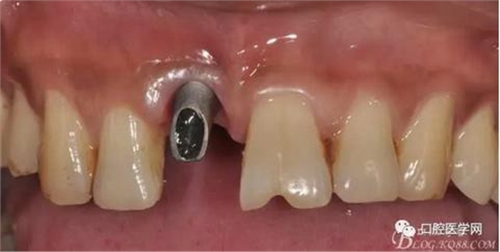 360截圖20170123113219966.jpg 360截圖20170123113219966.jpg