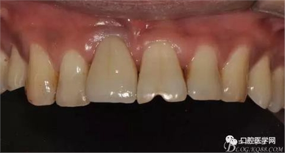 360截圖20170123113240262.jpg 360截圖20170123113240262.jpg