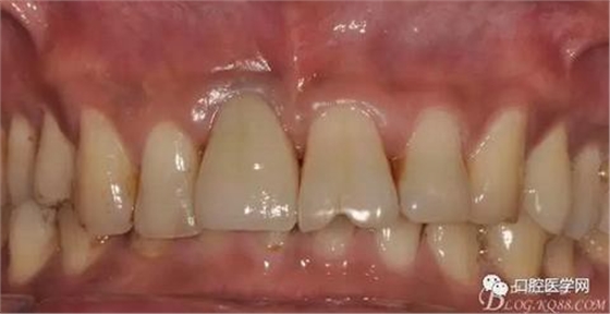 360截圖20170123113254222.jpg 360截圖20170123113254222.jpg