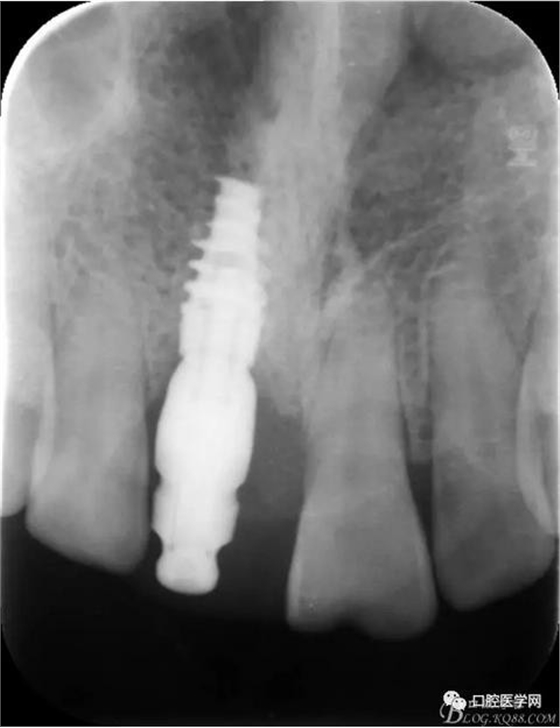 360截圖20170123113307387.jpg 360截圖20170123113307387.jpg