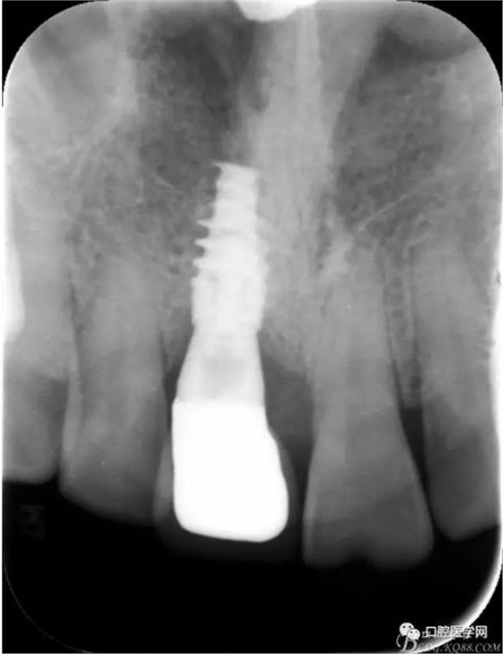 360截圖20170123113317739.jpg 360截圖20170123113317739.jpg