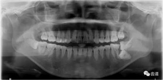 360截圖20170123164645777.jpg 360截圖20170123164645777.jpg