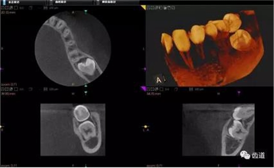 360截圖20170123164653643.jpg 360截圖20170123164653643.jpg