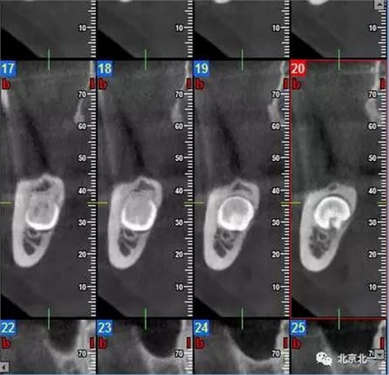 360截圖20170123204143843.jpg 360截圖20170123204143843.jpg