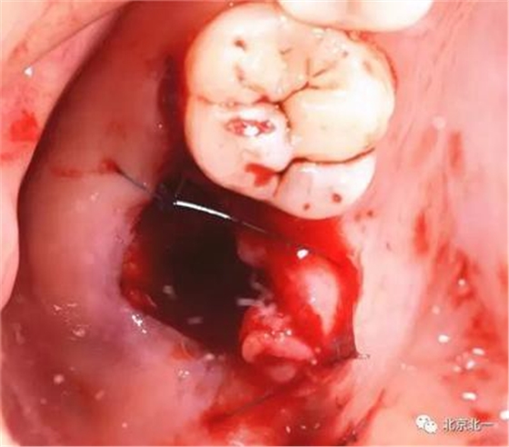 360截圖20170124104420294.jpg 360截圖20170124104420294.jpg