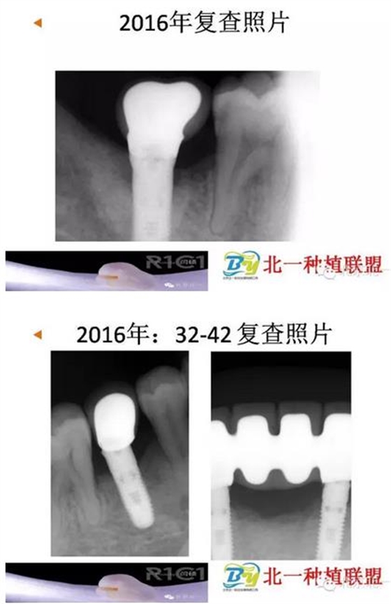 360截圖20170124112823232.jpg 360截圖20170124112823232.jpg