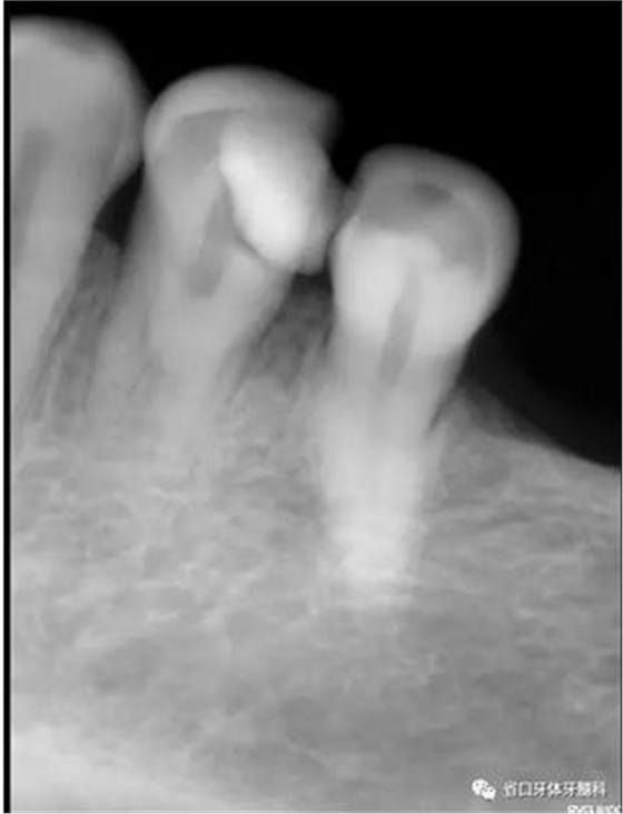 360截圖20170124165741896.jpg 360截圖20170124165741896.jpg