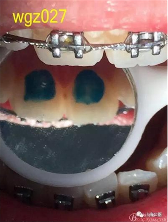 360截圖20170125142248978.jpg 360截圖20170125142248978.jpg