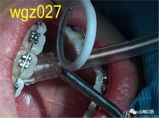 360截圖20170125142258065.jpg 360截圖20170125142258065.jpg