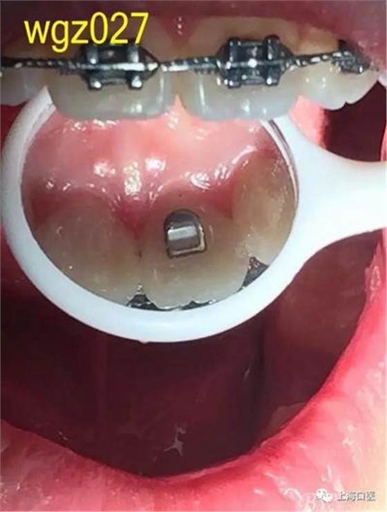 360截圖20170125142317292.jpg 360截圖20170125142317292.jpg